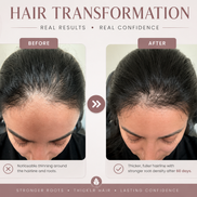 Root Reboot™ Hair Oil