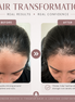 Root Reboot™ Hair Oil