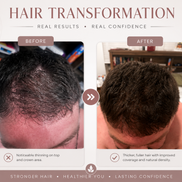 DHT Defense™ Hair Oil