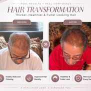 DHT Defense™ Hair Oil